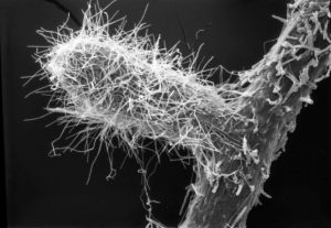 Mikroskopaufnahme einer Mykorrhiza